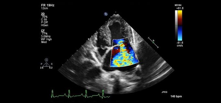 All about MSc Ecocardiography Course | Galaxy Education