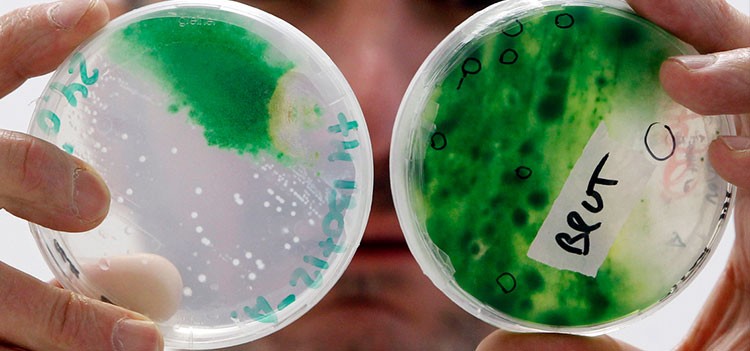 All you should know about MSc Microbiology Course