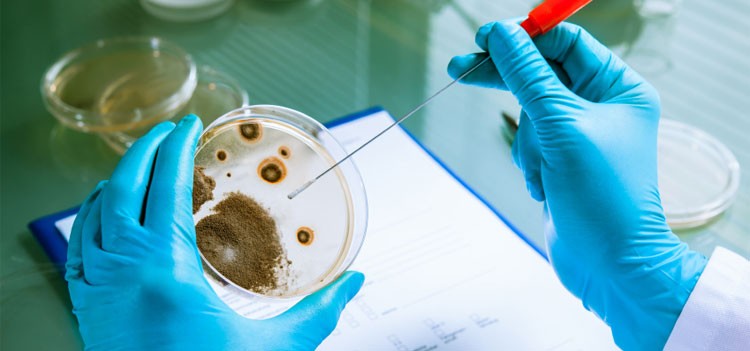 MSc Microbiology Admission in Bangalore